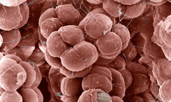 Arkeler (=Archaea)