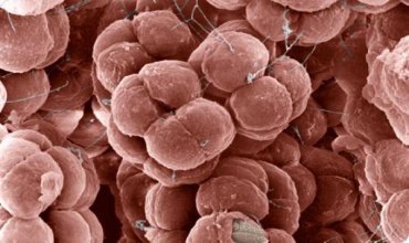 Arkeler (=Archaea)