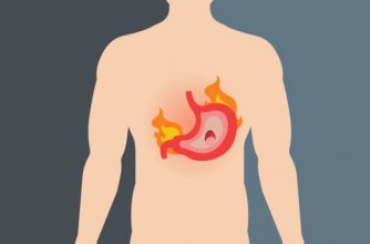 Gastrit